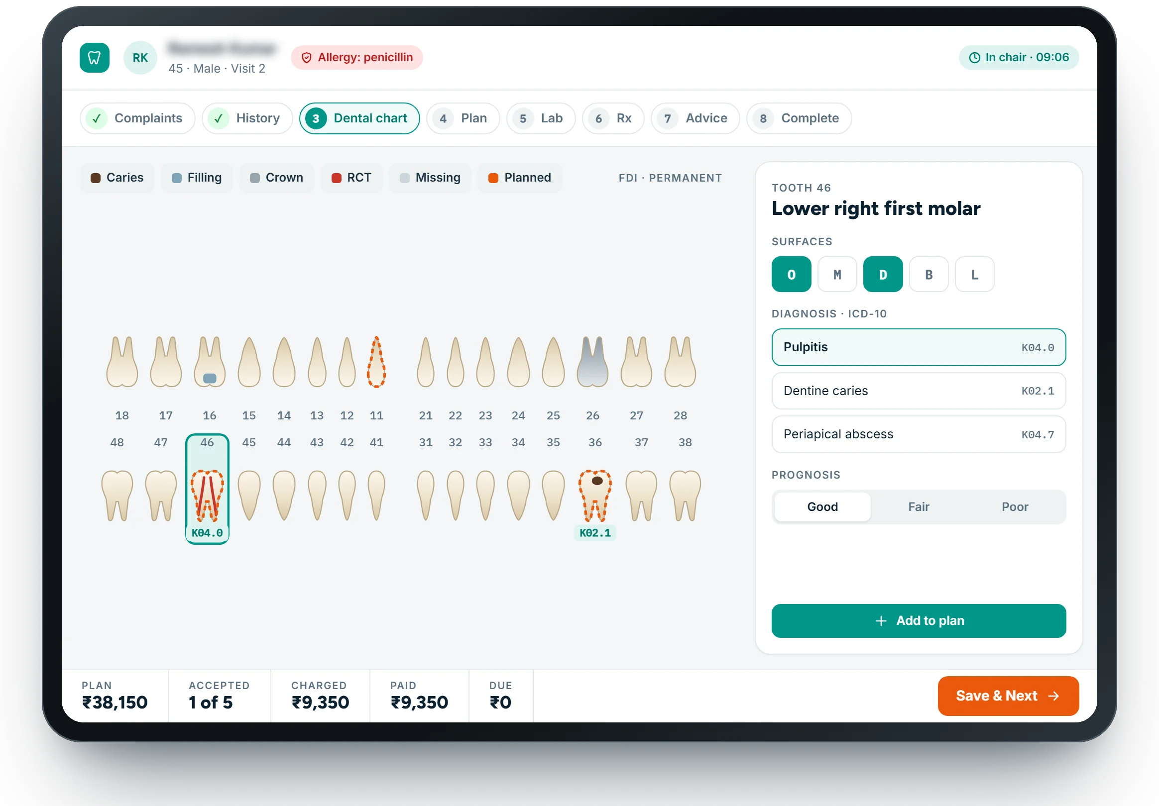 NexHIS Dental chart on a tablet: tooth 46 with the diagnosis panel